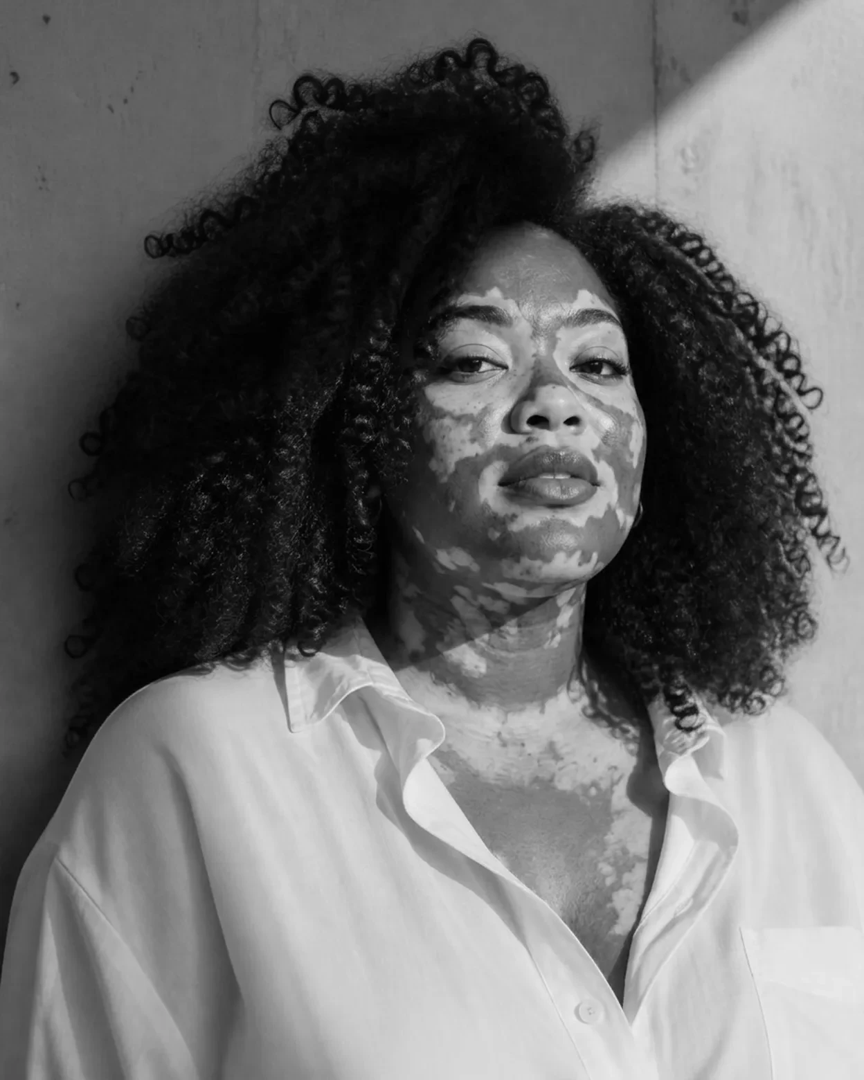 Porträt einer dunkelhäutigen Frau mit Vitiligo und Naturlocken vor heller Wand, Schwarzweiß.